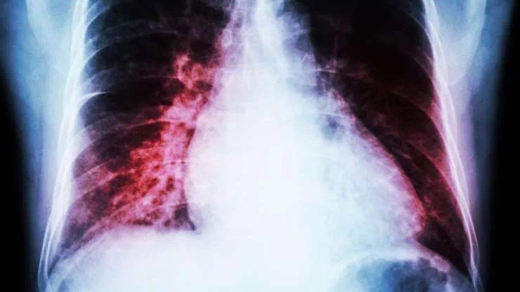 20190506_015514368_iOS